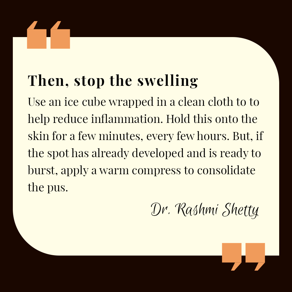 V3